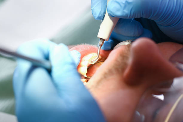 Best Pediatric Emergency Dentist in Olney, TX