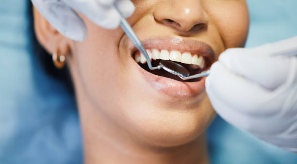 Best Emergency Denture Repair in Olney, TX