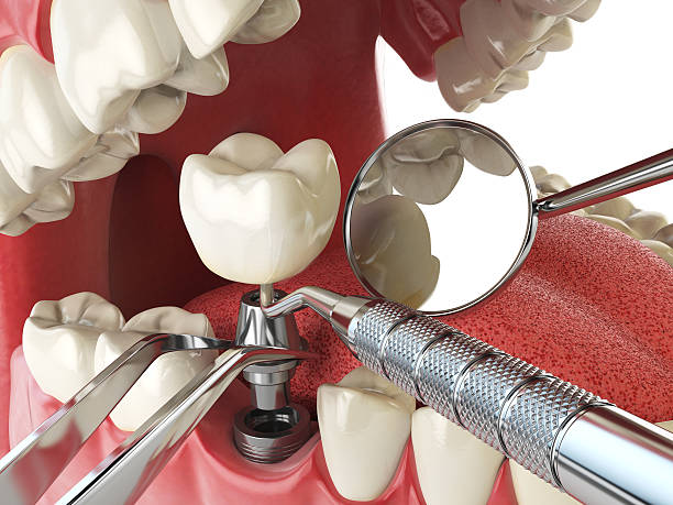 Best Cosmetic Emergency Dentistry in Olney, TX